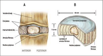 Figure 1: Disc Anatomy