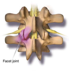 Figure 5: Facet Joints